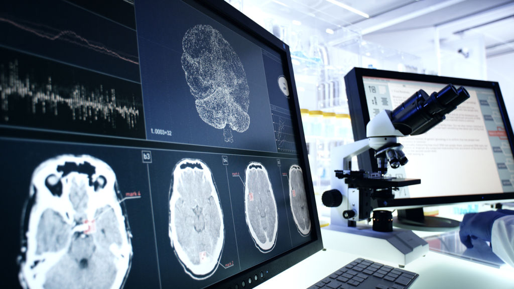 DEMENZE E NEURODEGENERAZIONE: innovazione diagnostica e approcci terapeutici integrati